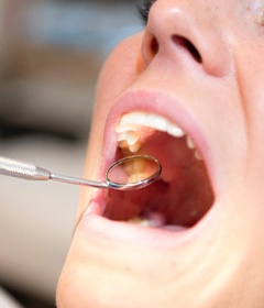 open mouth oral exam