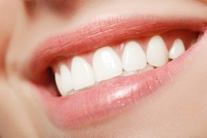 Facts about veneers to enhance your smile