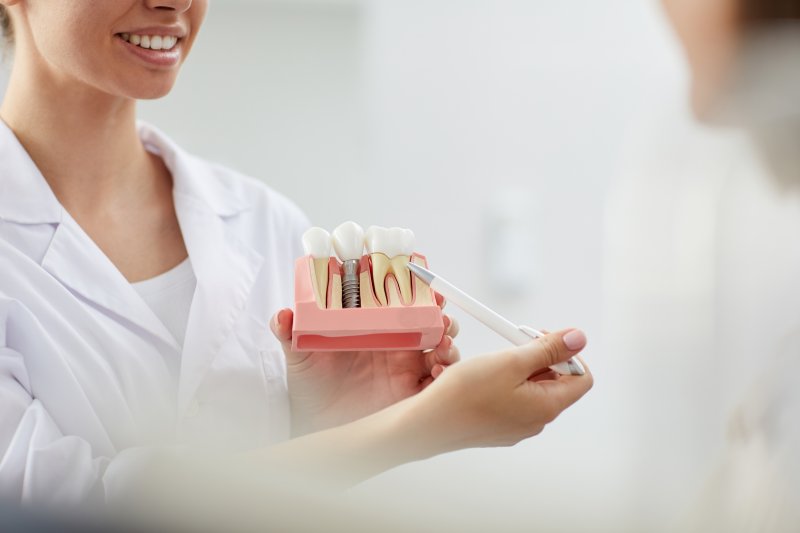dentist showing dental implant