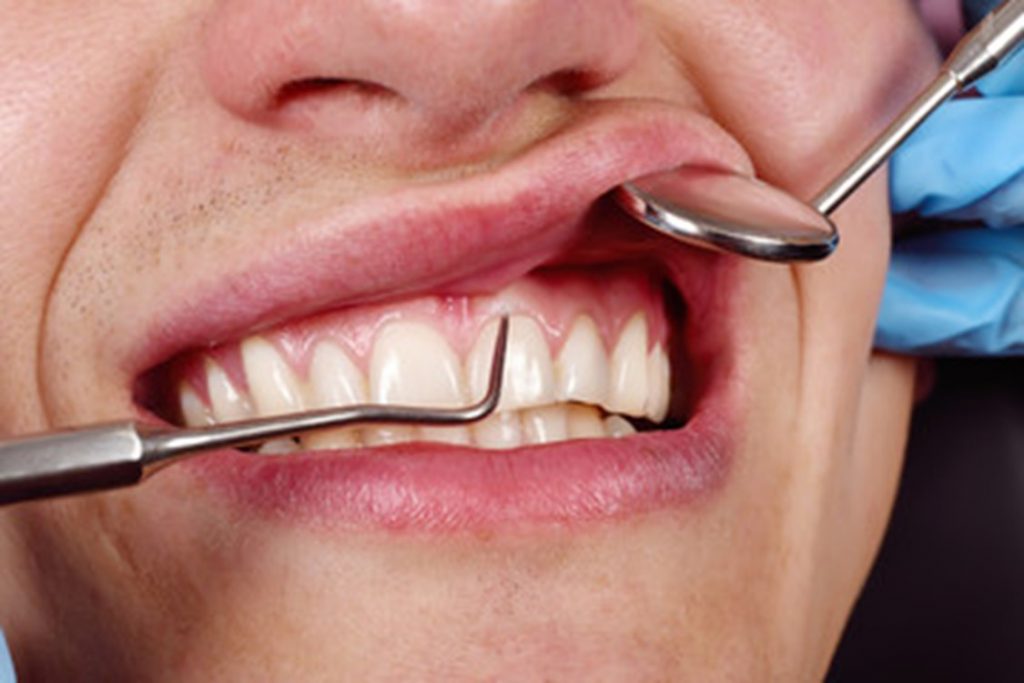 Dentist inspecting a patient's gums.