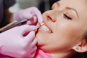 Woman having porcelain veneers placed