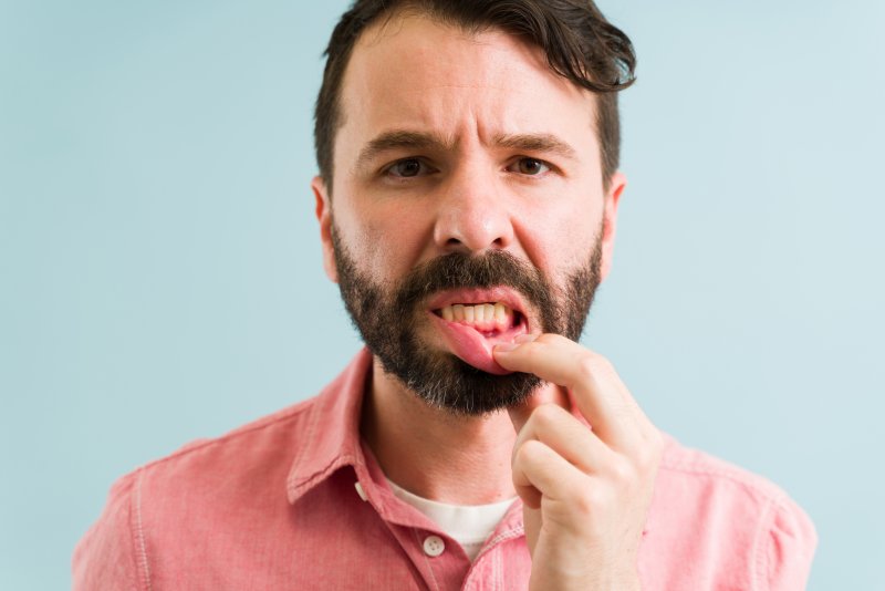 A man showing off his gum disease and looking confused