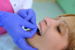 Woman getting dental veneers placed