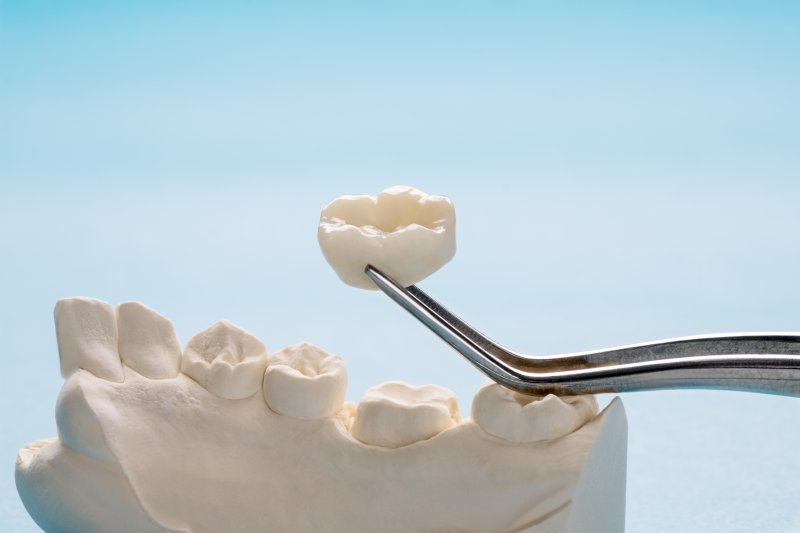 Tweezers grasping a ceramic dental crown
