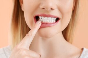 Woman with open mouth pointing to her teeth.