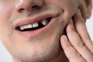 Nose-to-chin closeup of man touching jaw with a front tooth missing